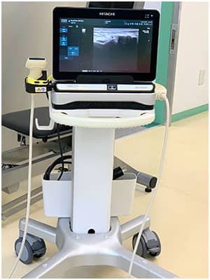 超音波観察装置の写真